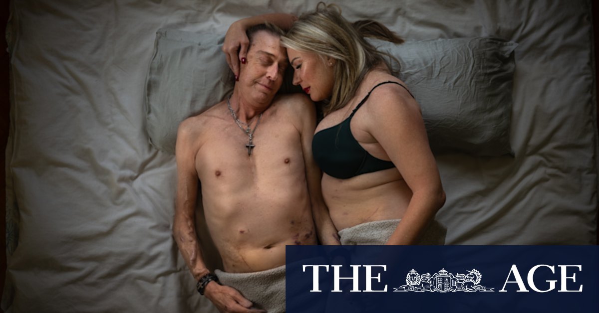 New drug Imlifidase gives hope to thousands of Australians with kidney failure - Vimarsana News