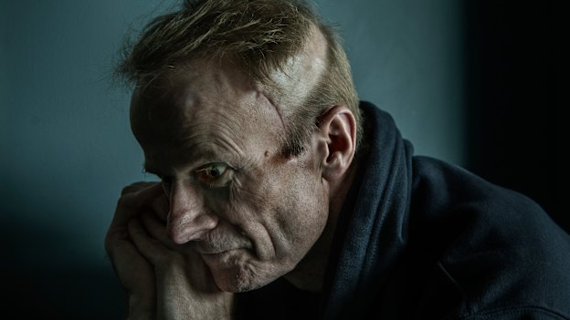 “I’m not at the capacity that I was some time ago”: Richard Scolyer.