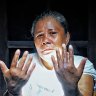 Tumini showing some of her scars from the Bali bombing. Her wounds were so ghastly that the hospital workers who received her assumed she was dead.