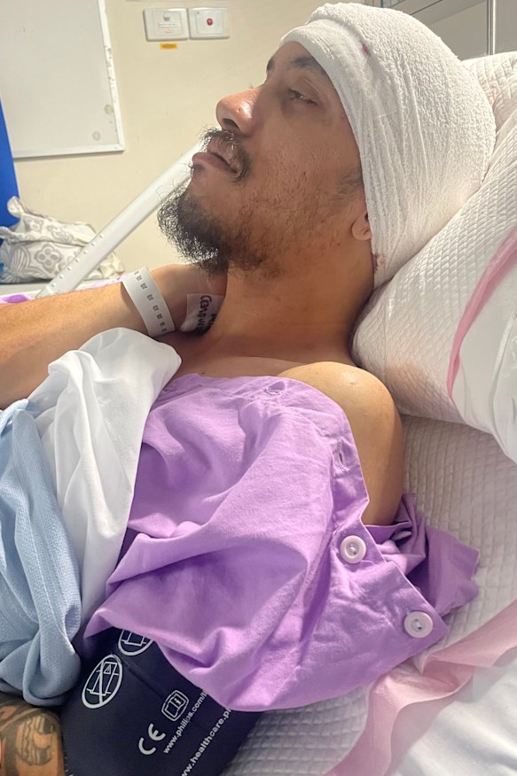 High after his brain surgery in April. 