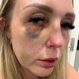 Perth mum Chloe Wright speaking out against a magistrate’s decision to release her abuser on bail after he pleaded guilty to assaulting her.