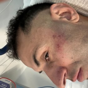 Sotounzadeh claims he was assaulted by police while protesting outside the Iran embassy. 