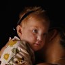 Ashton was born with a genetic condition and waited twice as long as was advised for important surgery.