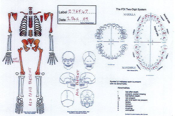 An inquest will try to identify skeletal remains found in Sydney's outer north-west in 1976 and held at the Australian Museum until 2013. 