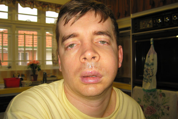 The police officer was almost unrecognisable as he healed from the facial injuries.