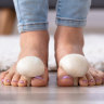 One in 10 people have toenail fungus. Here’s how to get rid of it