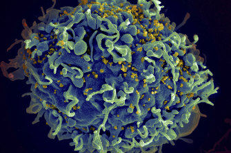 This electron microscope image shows a human T cell, in blue, under attack by HIV, in yellow. (Colours have been added for clarity.)