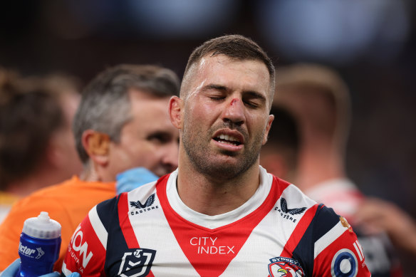 Rooster’s captain James Tedesco has failed his HIA and won’t return to the field.