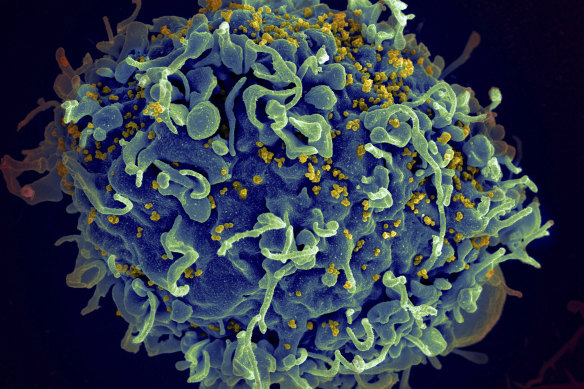 This electron microscope image shows a human T cell, in blue.