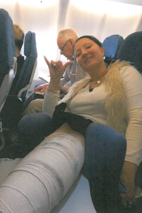 Anna Bowditch had to put her broken leg on a tray table on the flight back from Hawaii.