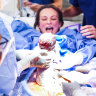 How this mother delivered her own daughter via caesarean