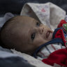 ‘It’s a catastrophe’: Little Mohammed among millions of starving children in Kabul