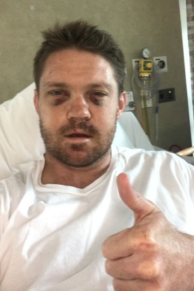 Black and blue: Chris Lawrence in his hospital bed in New Zealand.