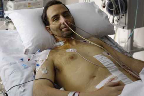 Brendan Cole shortly after the multi-visceral transplant in 2010. He says was unaccustomed to feeling so good after an operation.