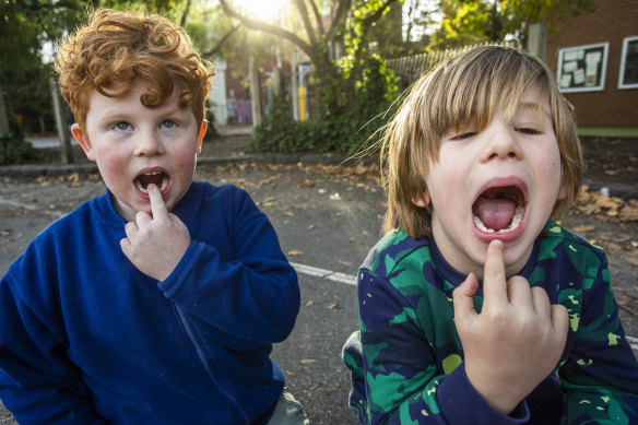 Six-year-old Jethro Peterson, left, and five-year-old Jude Kerr are keen to lose more teeth and wait for the tooth fairy.