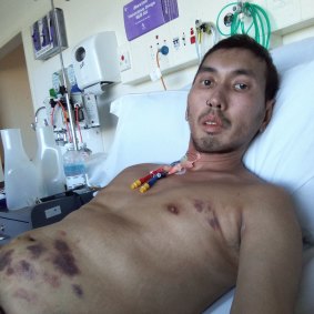 Khaidir Abu Jalil, a patient at St Vincents Hospital fighting a rare disease. 