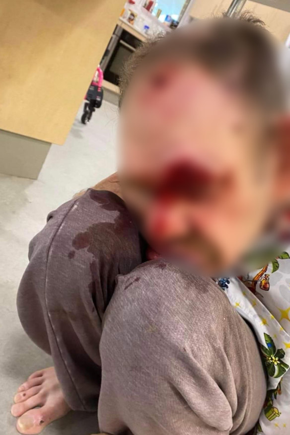 A whistleblower says this man, who cannot be identified for legal reasons, was left bleeding on the ground by staff at a NSW disability group home. 