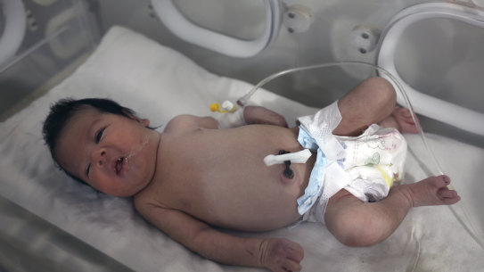 A baby girl born under the rubble caused receives treatment in an incubator at a children’s hospital in in the town of Afrin, Aleppo province, Syria. 