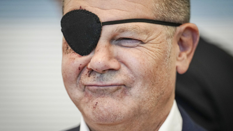 ‘Am excited to see the memes’: Olaf Scholz tweets picture of himself with eye patch