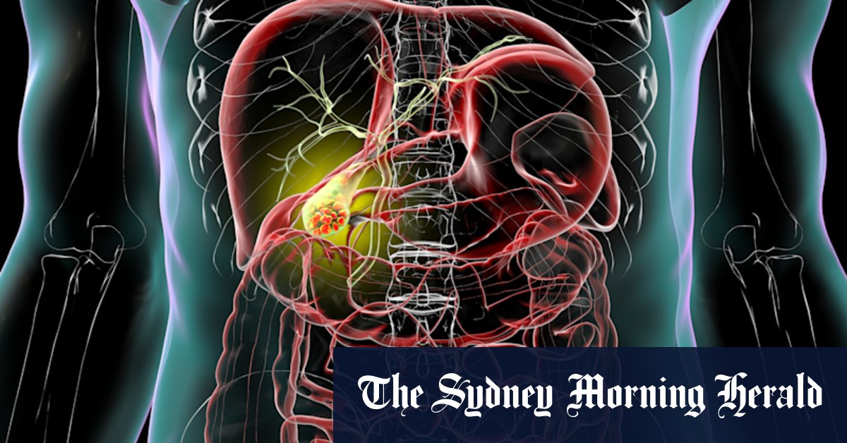 The organs you can live without: What happens when parts of you are removed?