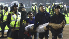 Soccer fans carry an injured man following clashes during a soccer match at Kanjuruhan Stadium in Malang, East Java.