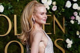 Nicole Kidman sporting a high pony at the Golden Globes.