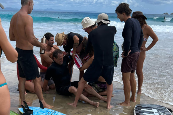 Beachgoers wrap a tourniquet around  Mat Cassidy’s arm at Wategos in February.