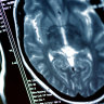 Non-medical staff operating on brains, spines after ‘learning on the job’