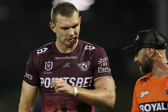 Star Sea Eagles fullback Tom Trbojevic left the field with a groin injury on Sunday.