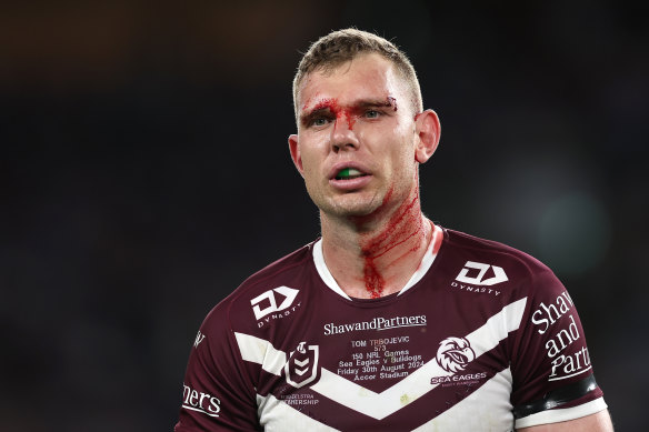 Tom Trbojevic’s fitness once again holds to key for Manly.
