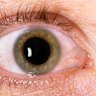 Eye health can reveal everything from your risk of Type 2 diabetes to 