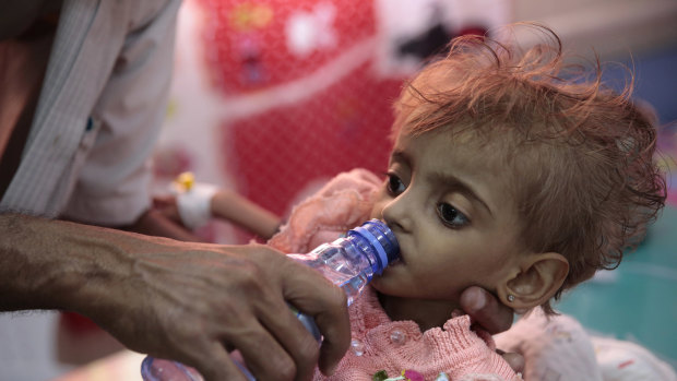 A father gives water to his malnourished daughter at a feeding centre in a hospital in Hodeida, Yemen.