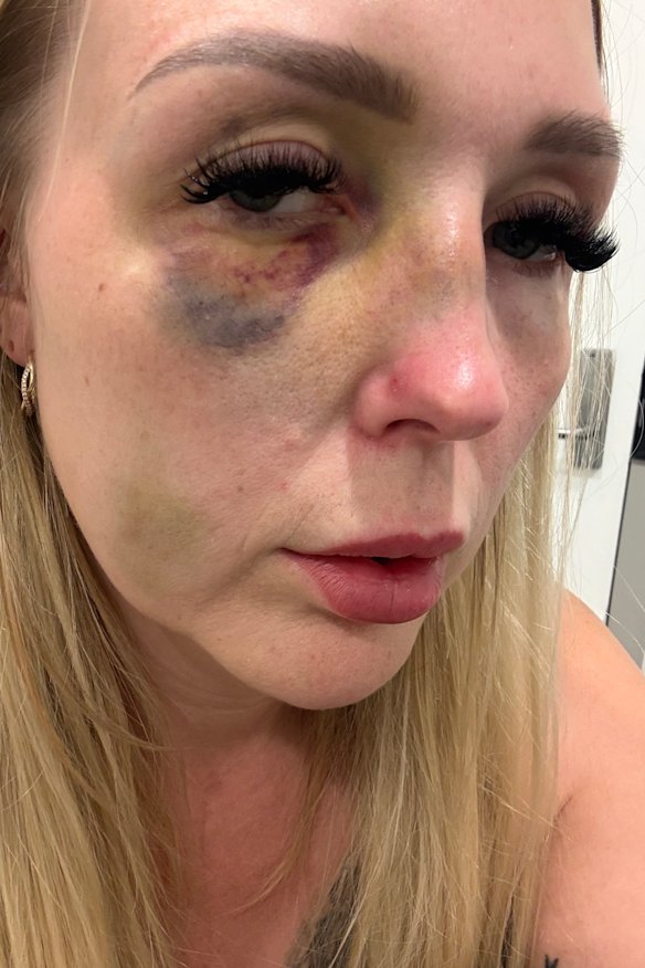 Wright was left with serious injuries after the assault.