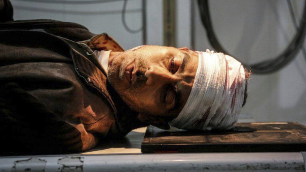 An injured Syrian man, who was wounded by the shelling of the Syrian government in Ghouta, Damascus, Syria. 