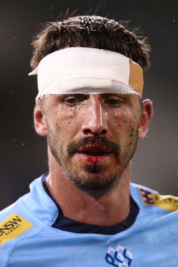 Jake Gordon looking worse for wear.