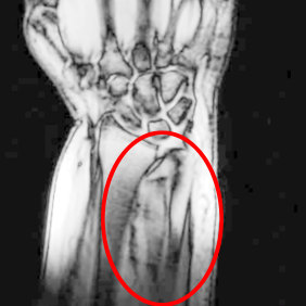 The face discovered in an MRI of Eden O’Mara’s hand.