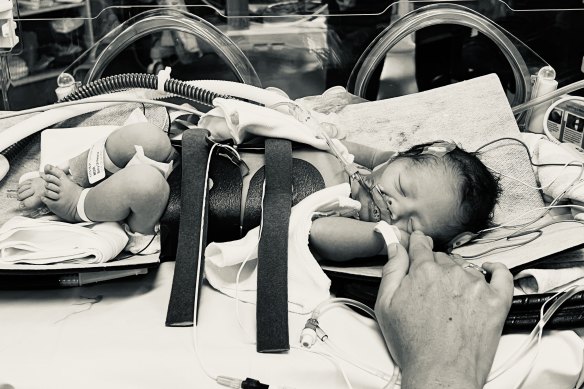 Ethan Moir, born on January 2, 2022, spent six days in the neonatal intensive care unit in Randwick.