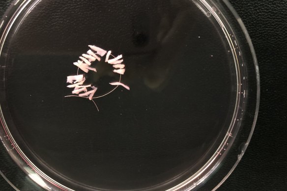 A thread of tiny ovarian grafts, on pieces of suture material, ready to be returned to the patient’s body.
