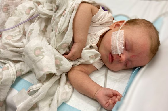 Eight-week-old Ebony Mead had to be fitted with a feeding tube after contracting RSV late last year.