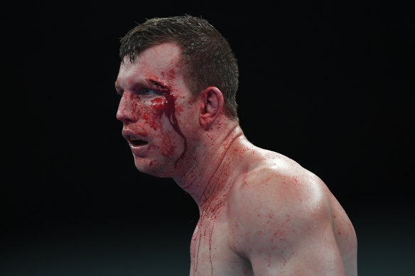The fight was stopped for Horn to have a cut above his eye checked out.