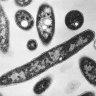 Legionnaires’ disease outbreak detected in Melbourne’s south-east
