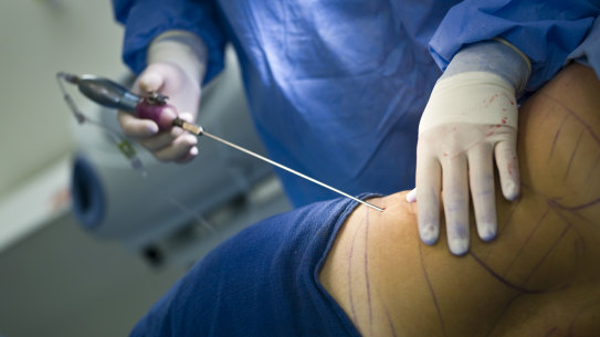 The HCCC is concerned that non-staff at the clinic were performing invasive surgical procedures such as breast augmentation without a medical practitioner present. 