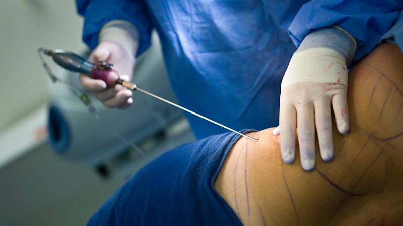Calls grow for greater transparency in medical watchdog malpractice investigations