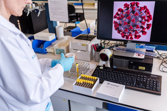 A magnified coronavirus seen during sample detection tests in Belgium. 