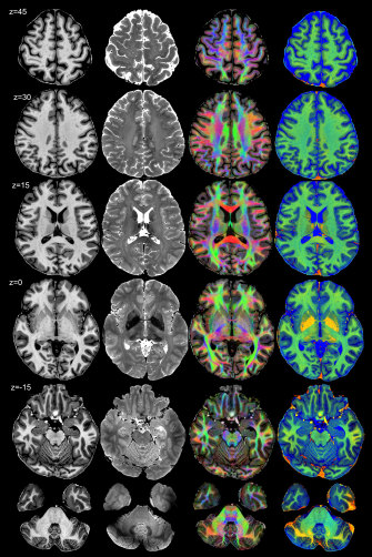 MRIs of a living human brain.