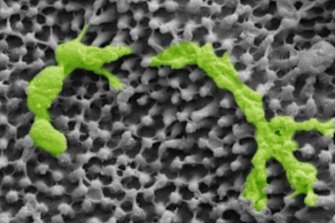Streptococcus bacteria, highlighted in green, rest on cicada wings.