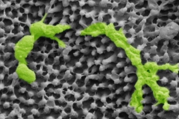 Streptococcus bacteria, highlighted in green, rest on cicada wings.