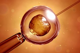 Egg freezing requires as much intervention as egg-retrieval for IVF, but, as yet, birth rates from frozen eggs are far lower than for IVF..