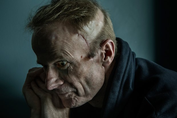 “I’m not at the capacity that I was some time ago”: Richard Scolyer.