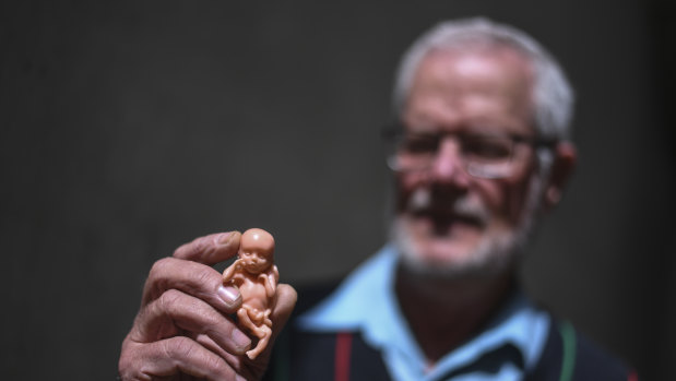 Anti-abortion activist John Preston holds up a model of a 12-week-old fetus outside the High Court on Tuesday.